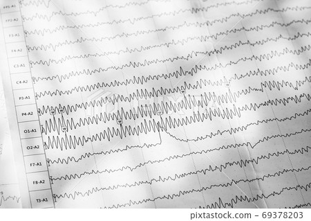 Electroencephalogram result on paper closeup, brain activity test Electroencephalogram result on paper closeup, brain activity test 69378203