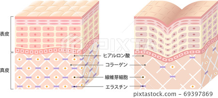 前後皺紋皮膚的橫截面圖 69397869