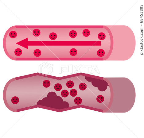 血管特徵 69453895