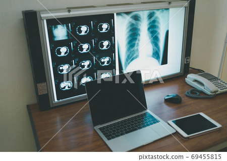 x光透射片 射線掃描 醫療和醫學 69455815