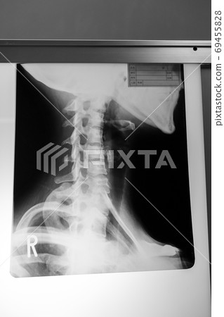 radiograph, x-ray photo, bone 69455828
