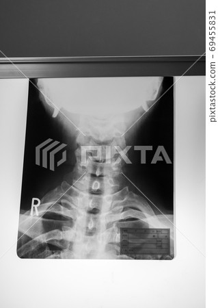 radiograph, x-ray photo, bone 69455831