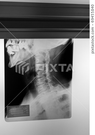 radiograph, x-ray photo, bone 69455840