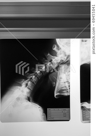 radiograph, x-ray photo, bone 69455841