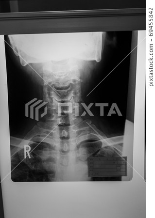radiograph, x-ray photo, bone 69455842
