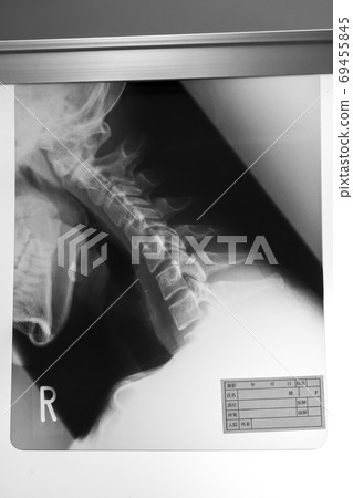 radiograph, x-ray photo, bone 69455845