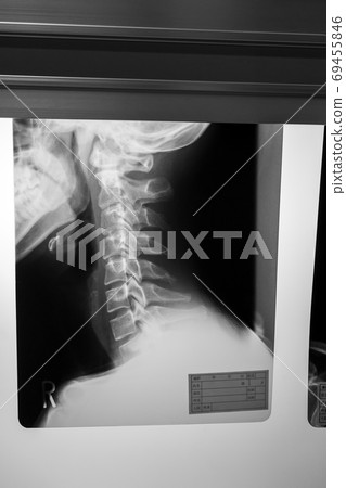 radiograph, x-ray photo, bone 69455846