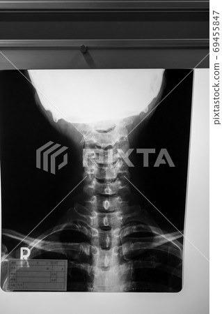 radiograph, x-ray photo, bone 69455847