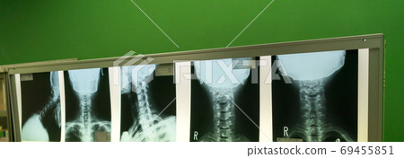 radiograph, x-ray photo, bone 69455851