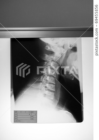 radiograph, x-ray photo, bone 69455856