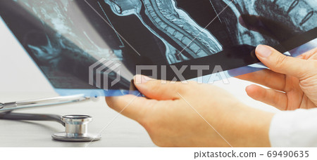 Female doctors hand pointing at x-ray medical imaging at a shoulder condition Female doctors hand pointing at x-ray medical imaging at a shoulder condition 69490635