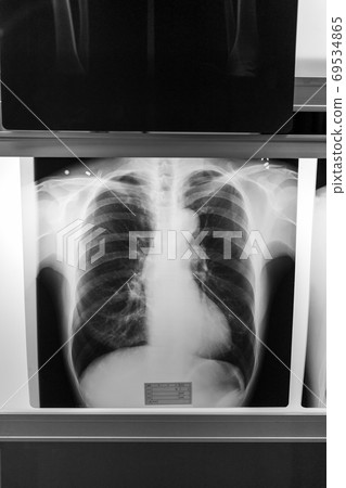 心 心臟的 肝臟 69534865