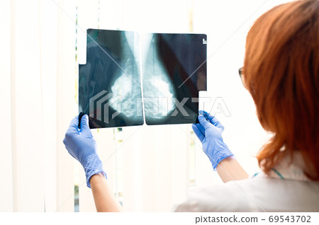 The doctor looks at the x-ray of the female mammary glands 69543702