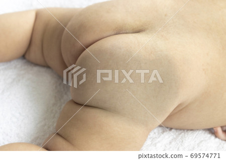 Mongolian spots on a 2-month-old baby Mongolian spots on a 2-month-old baby 69574771