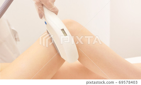 Laser elos medical device. Remove unwanted hair and asteriks. Cosmetology 69578403