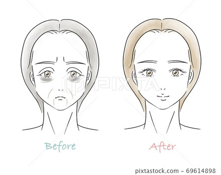 Before and After of face by cosmetic surgery 69614898