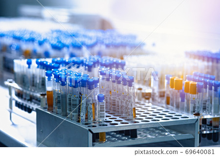 Test tubes with biomaterial in the laboratory Test tubes with biomaterial in the laboratory 69640081