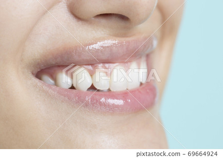 White tooth women White tooth women 69664924