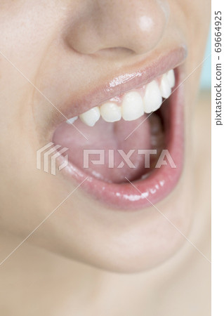 White tooth women White tooth women 69664925