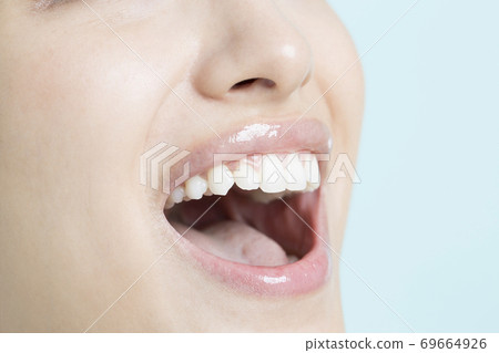White tooth women White tooth women 69664926