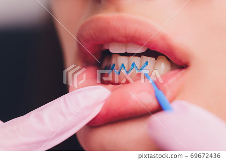 Close-up portrait of a female patient visiting dentist for teeth whitening in clinic,Teeth whitening procedure. Close-up portrait of a female patient visiting dentist for teeth whitening in clinic,Teeth whitening procedure. 69672436