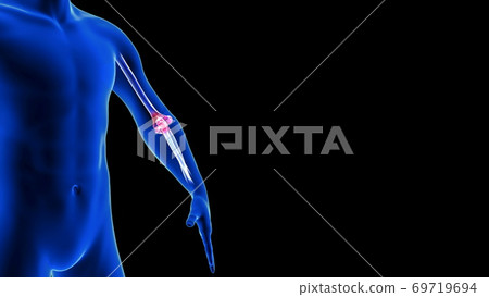 Elbow Pain close-up animation. Blue Human... - Stock Illustration  [69719694] - PIXTA