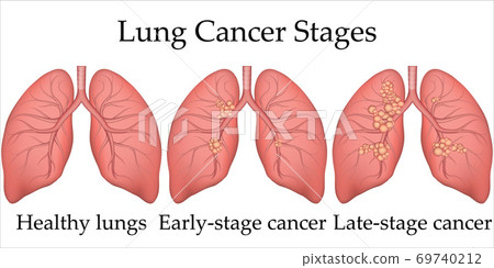 healthy human lung