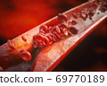 Artheriosclerosis close up 69770189