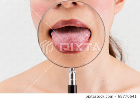 Bug glasses and tongue close-up. Bug glasses and tongue close-up. 69770641