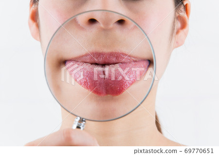 Bug glasses and tongue close-up. Bug glasses and tongue close-up. 69770651