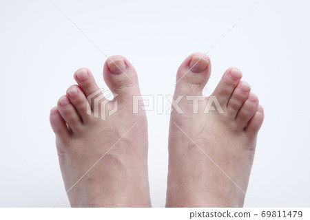 Men barefoot 69811479