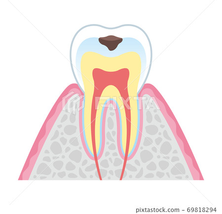 tine, vector, vectors 69818294