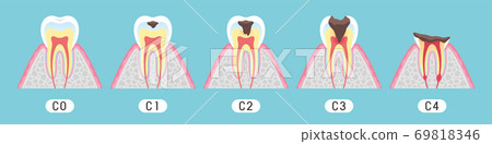 tine, cross-section diagram, vector 69818346