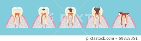 tine, cross-section diagram, vector 69818351
