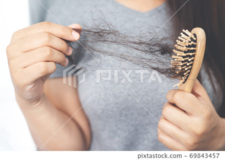 Women with hair loss Because she is allergic to shampoo Women with hair loss Because she is allergic to shampoo 69843457