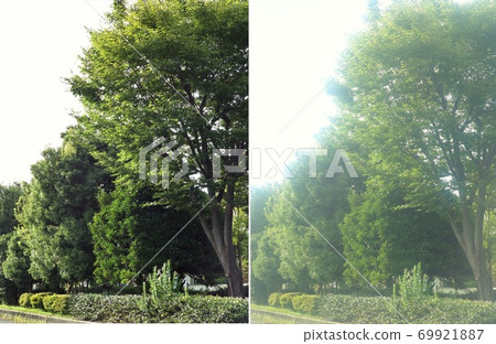 Image of cataract 69921887