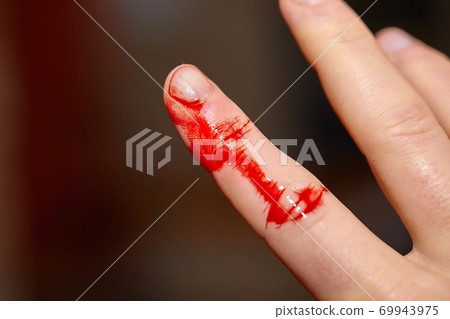 Cut finger bleeding 69943975