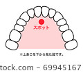 Tongue spot illustration 69945167