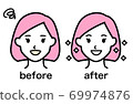 Whitening Before After (Female) 69974876