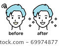 Whitening Before After (Male) 69974877