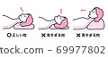 Correct pillow Too low pillow Too high pillow (female) 69977802