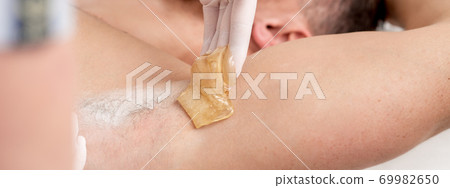Cosmetologist applying wax paste on male armpit Cosmetologist applying wax paste on male armpit 69982650