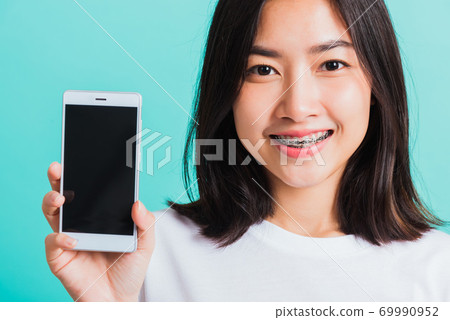woman smile have dental braces on teeth laughing she hold and show smart mobile phone blank screen 69990952
