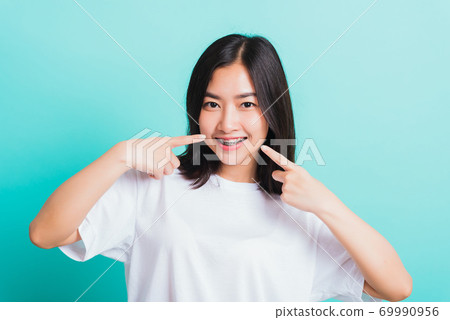 woman smile have dental braces on teeth laughing point finger her mouth woman smile have dental braces on teeth laughing point finger her mouth 69990956