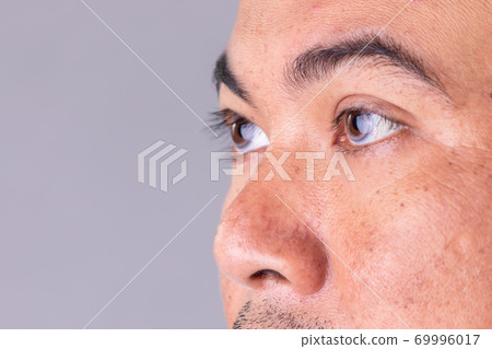 Face skin of asian man to show many skin problem. Men skin care concept on grey space background Face skin of asian man to show many skin problem. Men skin care concept on grey space background 69996017