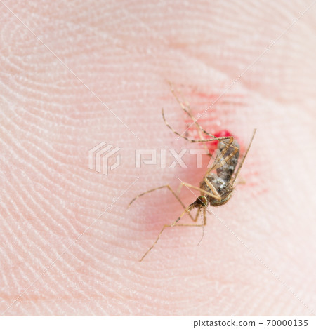 Slap a mosquito Slap a mosquito 70000135