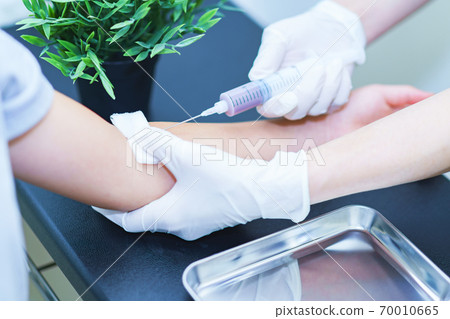 採血，獻血，人體碼頭，過敏測試[醫學圖像] 70010665