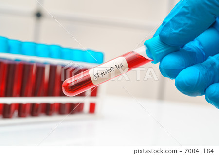 Blood sample test tube in doctor hand for NT-proBNP test Blood sample test tube in doctor hand for NT-proBNP test 70041184