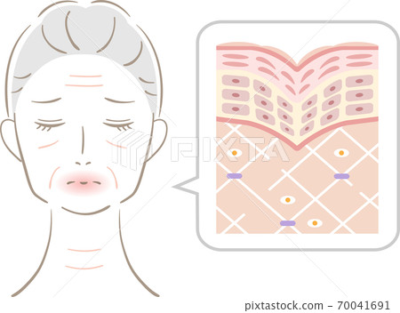 皺紋的女性的剖視圖 皺紋的女性的剖視圖 70041691