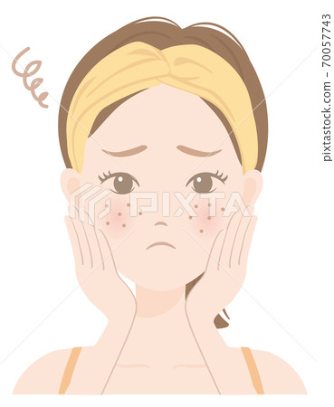 Women's skin care B_14 Women suffering from rough skin 70057743